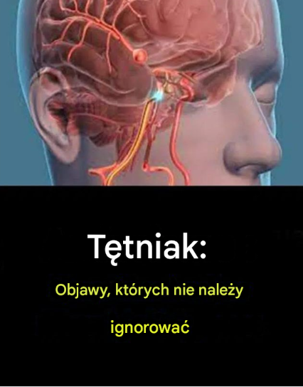 Tętniak: ciche objawy, które mogą uratować Ci życie – nie ignoruj ​​ich