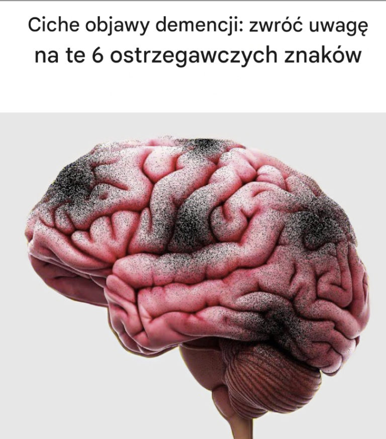 Ciche objawy demencji: zwróć uwagę na te 6 ostrzegawczych znaków