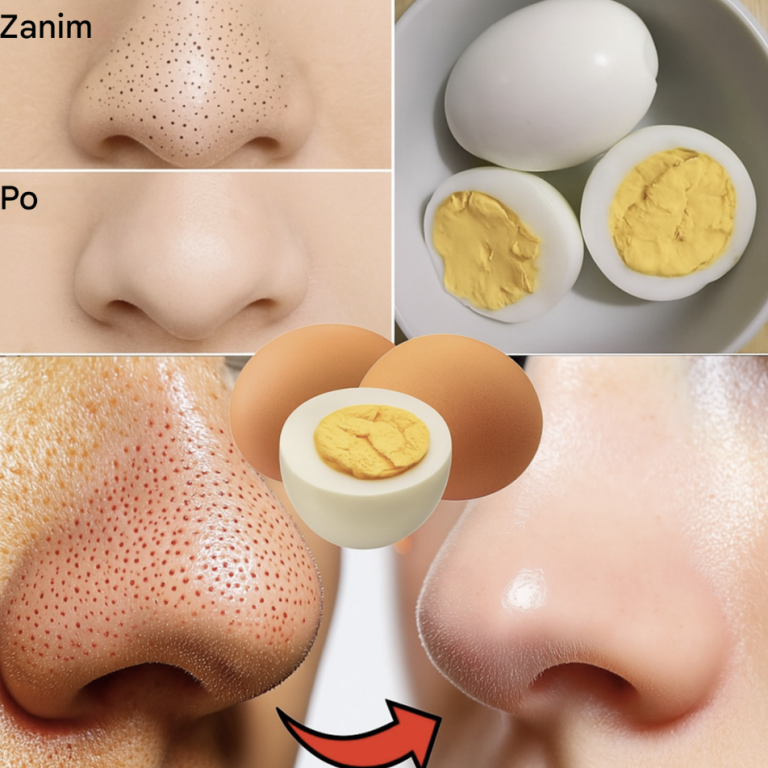 Jak pozbyć się zaskórników za pomocą jednego jajka?