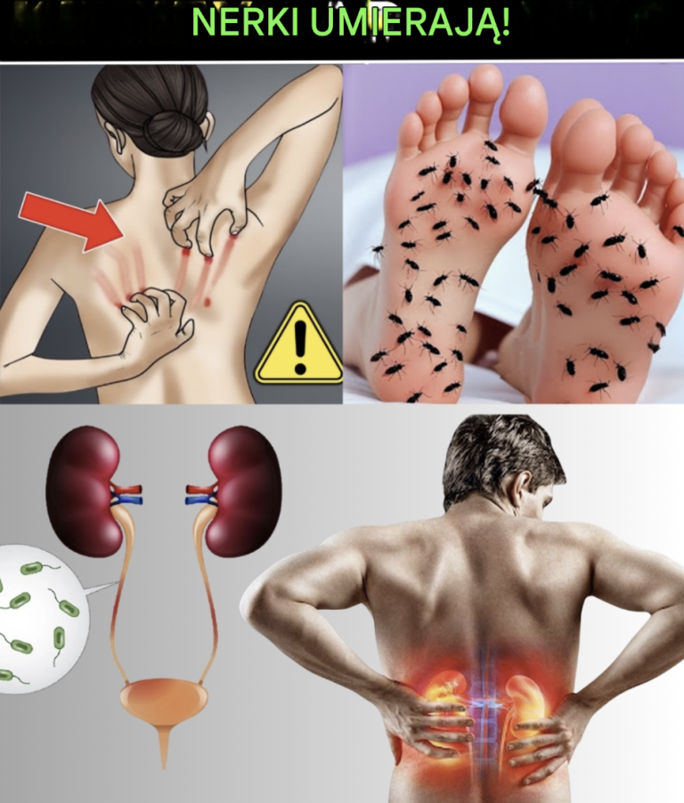 15 śmiertelnych objawów chorób nerek, które musisz wykryć wcześnie
